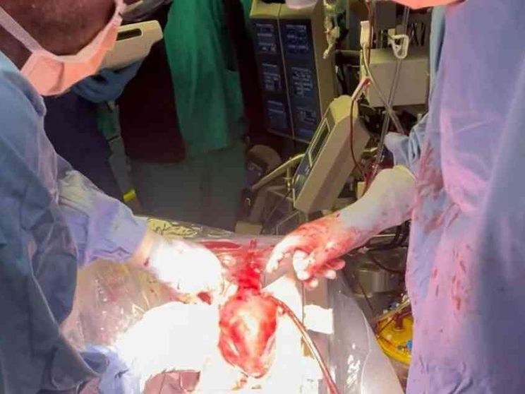 Perché il trapianto “a cuore battente” non crea problemi etici