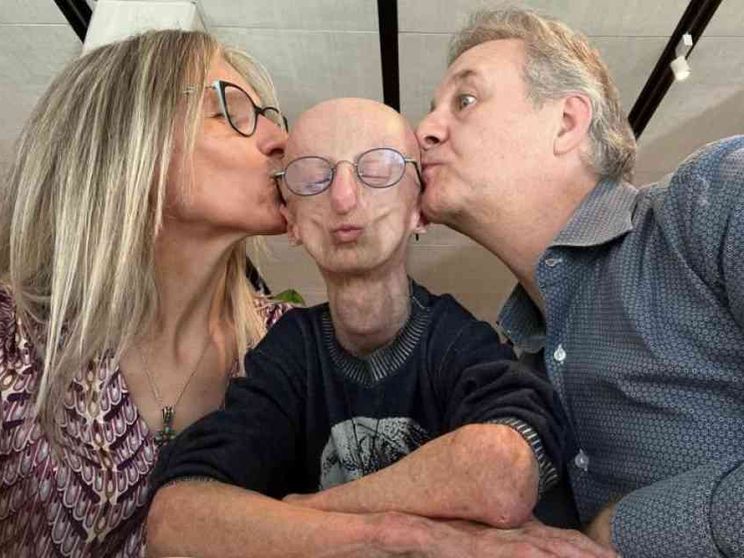 I genitori di Sammy Basso: «Ci ha insegnato a vivere una vita piena»