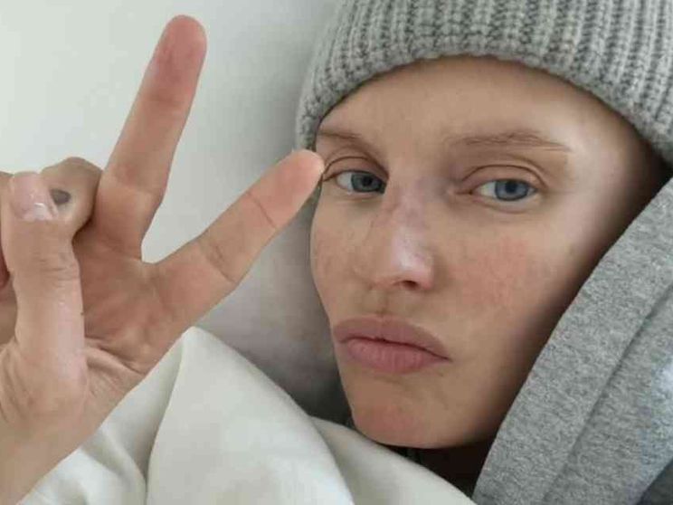 Bianca Balti a Sanremo, la malattia raccontata col sorriso