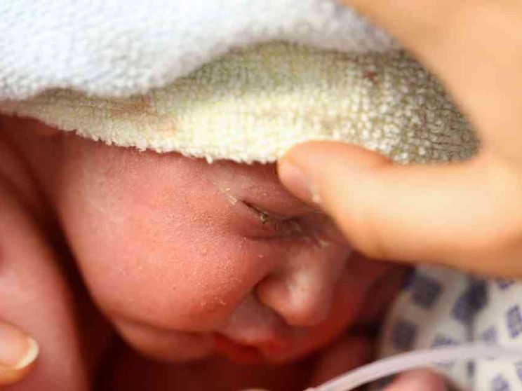 Il paradosso marchigiano: meno posti per nascere che per abortire