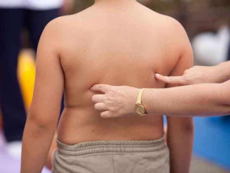 Un bambino su 3 in eccesso di peso: troppo cibo e poco movimento