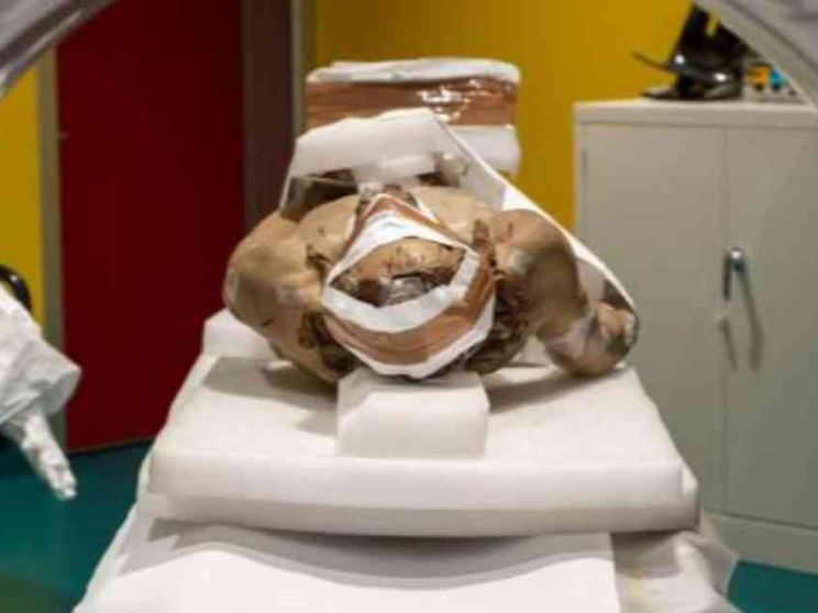 Come la radiologia può salvare anche le belle arti