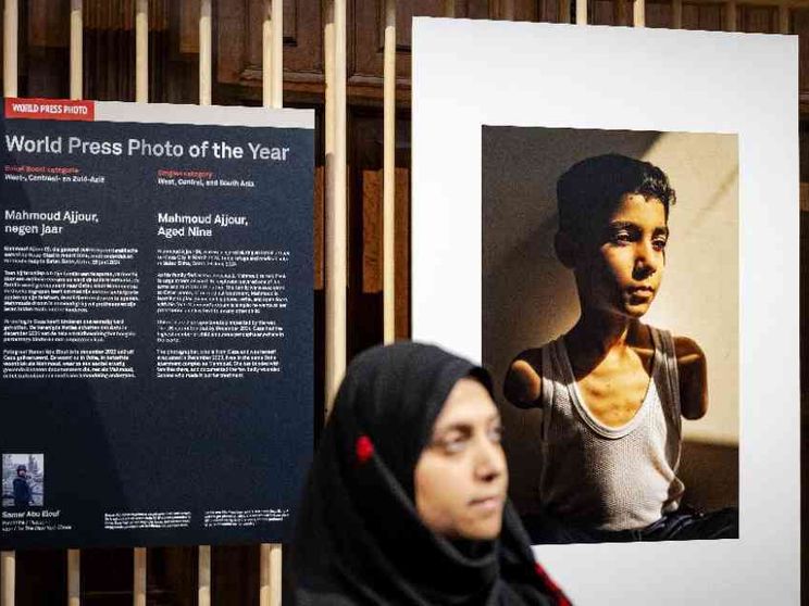 Vince il World Press Photo l'immagine di un bimbo amputato di Gaza