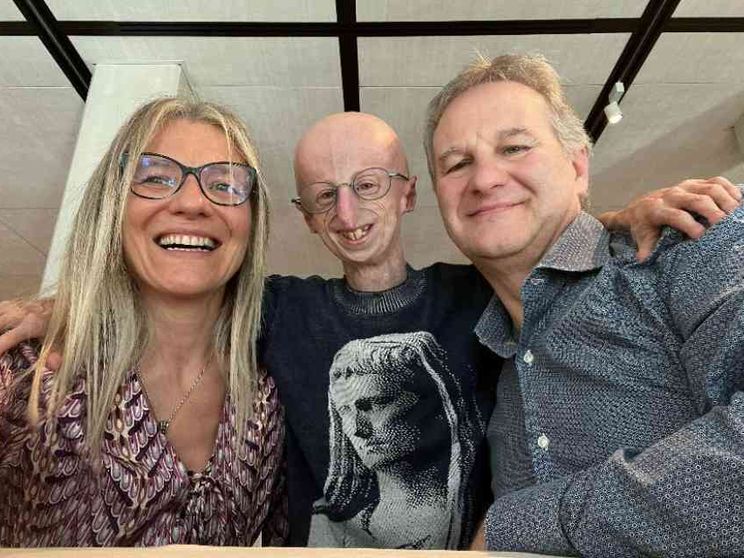 «Mio figlio Sammy Basso e gli studi per curare la malattia (ma non per sé)»