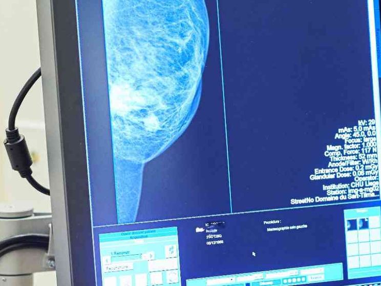 Nelle nuove prestazioni sanitarie più esami preventivi per i tumori