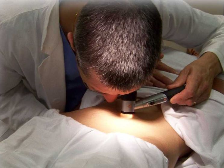 Giovedì 19 a Roma screening dermatologici gratuiti