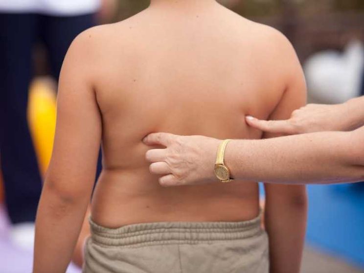Epidemia di obesità, come si ferma?