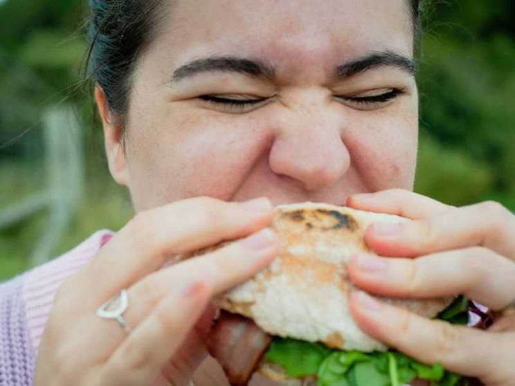 I bambini obesi superano quelli sottopeso: e non è una buona notizia