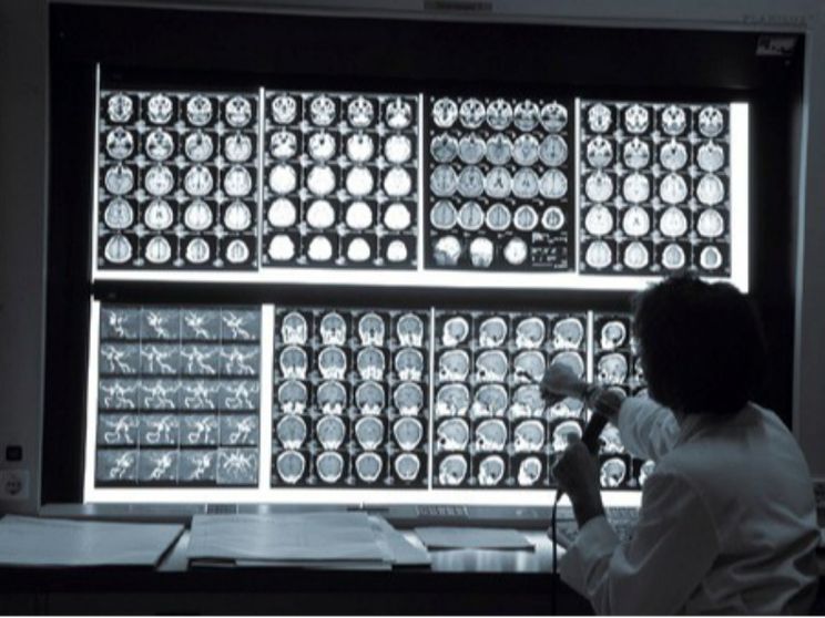 «Via gli ostacoli ai sogni dei bambini con disabilità visiva»