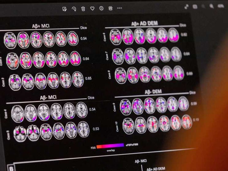 86 miliardi di neuroni “svelano” i nostri pensieri