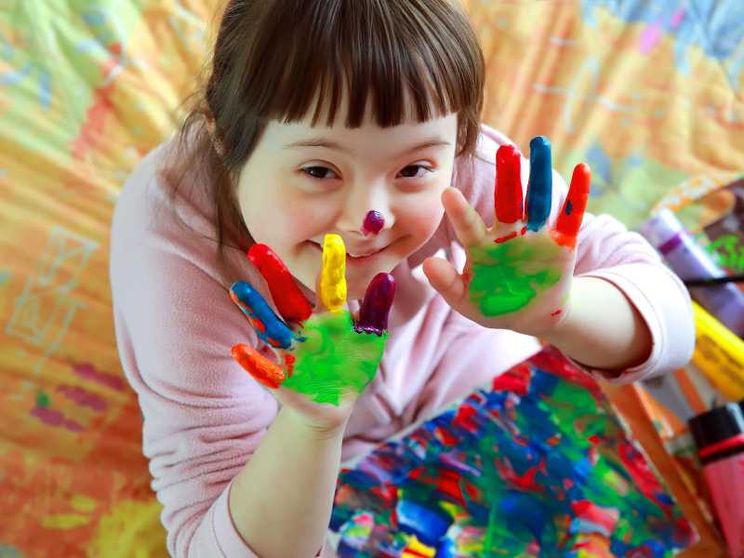 Sindrome di Down, una scoperta italiana può dare la svolta