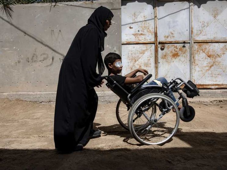 Tende infestate di topi e parassiti, malformazioni: le piaghe di Gaza