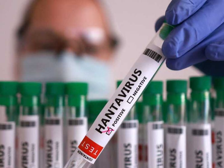 Un test positivo all'hantavirus