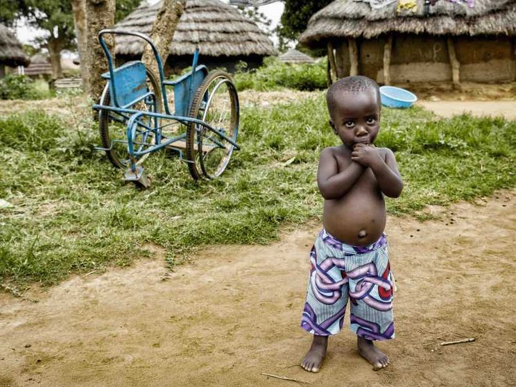 Oltre la disabilità, in Uganda: il sorriso ritrovato di Ocean, Margaret e altre 40mila persone