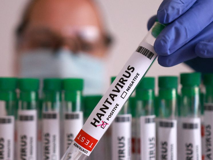 Un test positivo all'hantavirus