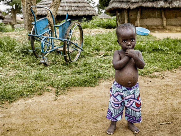 Oltre la disabilità, in Uganda: il sorriso ritrovato di Ocean, Margaret e altre 40mila persone