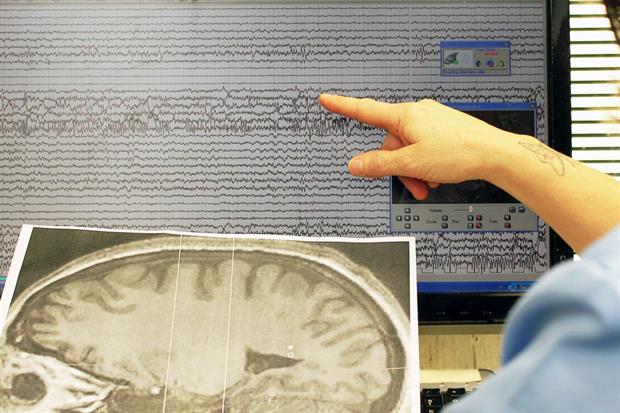 Foto del tracciato delll'elettroencefalogramma di un epilettico
