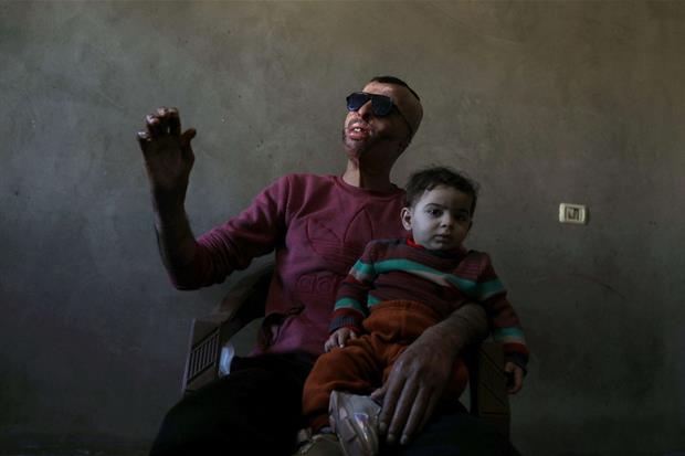 Ahmed al-Natour, palestinese di 34 anni rimasto gravemente ustionato in un incendio l'anno scorso, prova la sua maschera tenendo suo figlio in braccio in casa, a Gaza