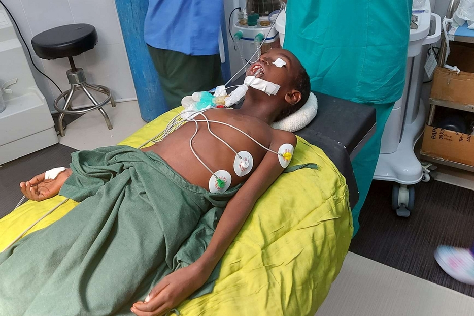 Un paziente di sei anni con palatoschisi in sala operatoria il primo luglio
