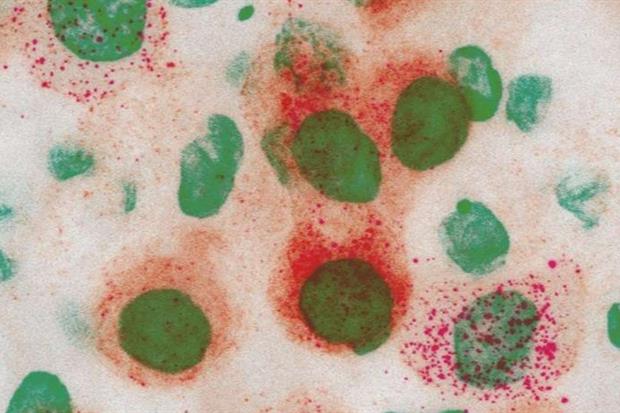 Cellule epiteliali bronchiali infettate dal virus SARS-CoV-2. I nuclei delle cellule sono colorati di verde, la proteina Spike in rosso.