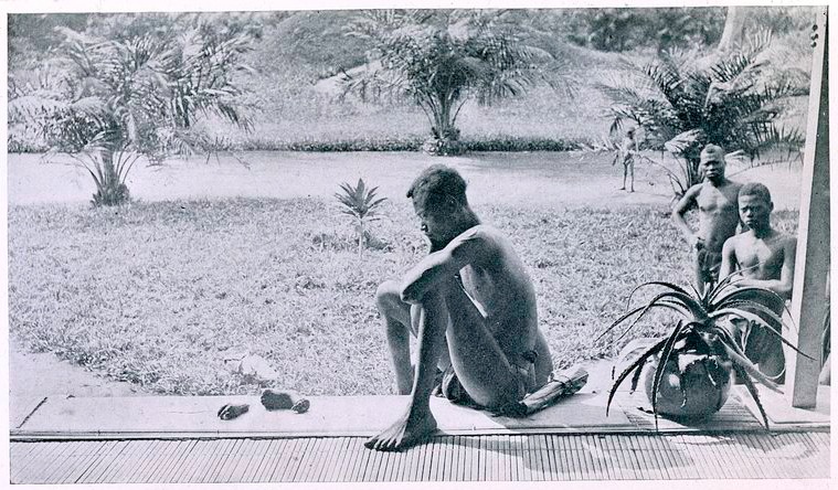 Un uomo in Congo guarda la mano e il piede mozzati della figlia di cinque anni, 1904