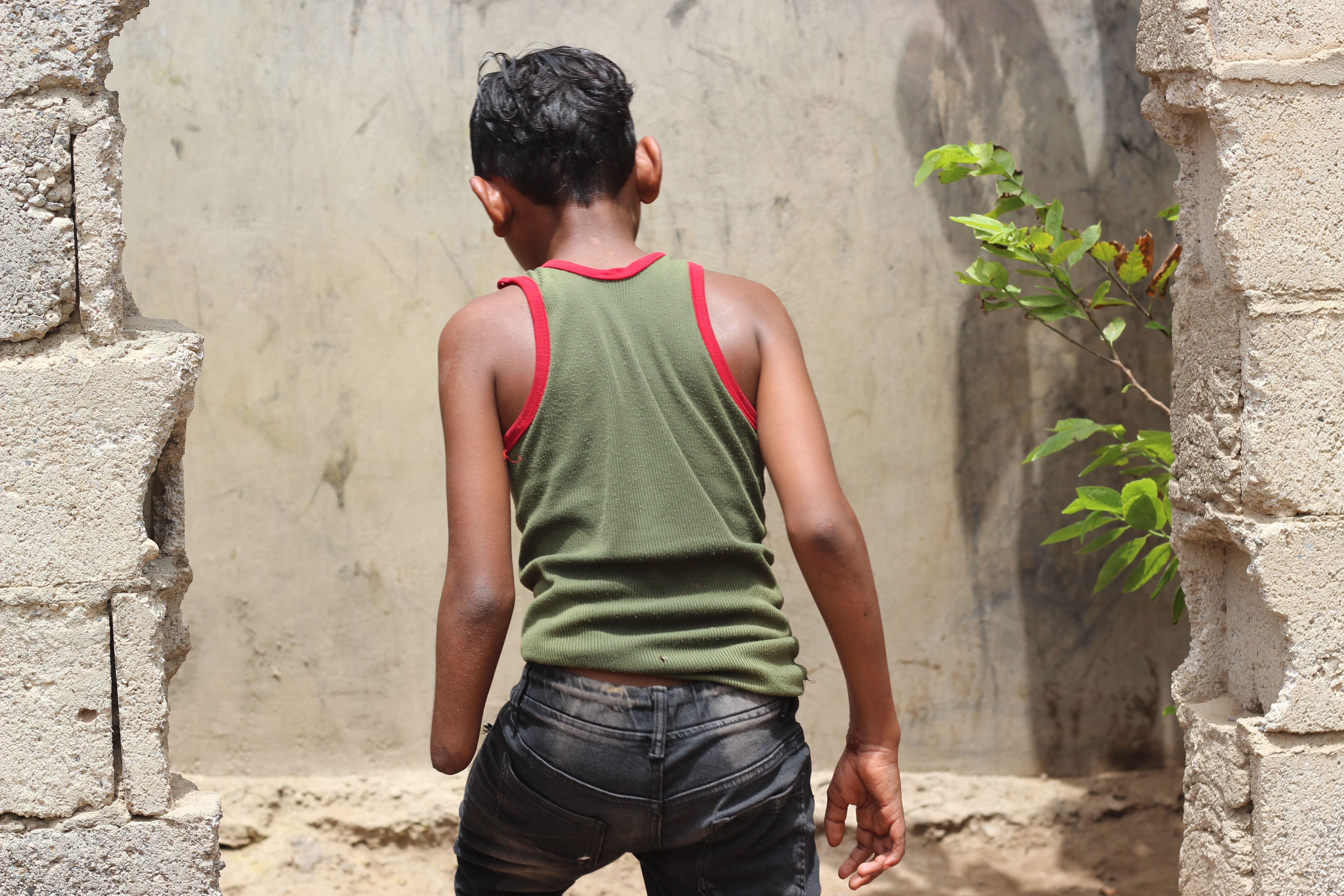 Tareq, 12 anni, ferito da un missile