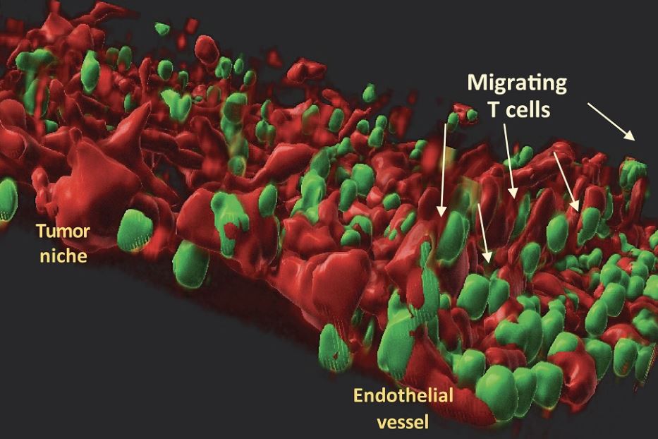 In un chip, un modello 3D riproduce il microambiente in cui prospera il tumore, incluse le cellule endoteliali e le cellule T del paziente
