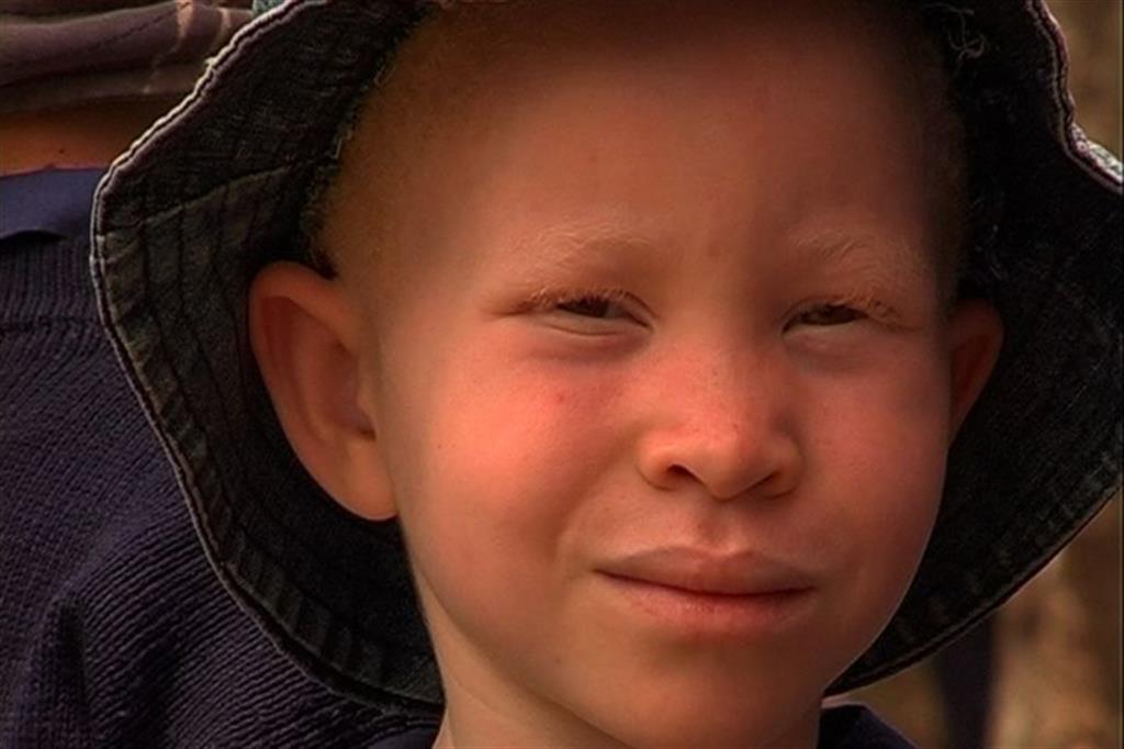 «Albini, in Africa massacro senza precedenti» 