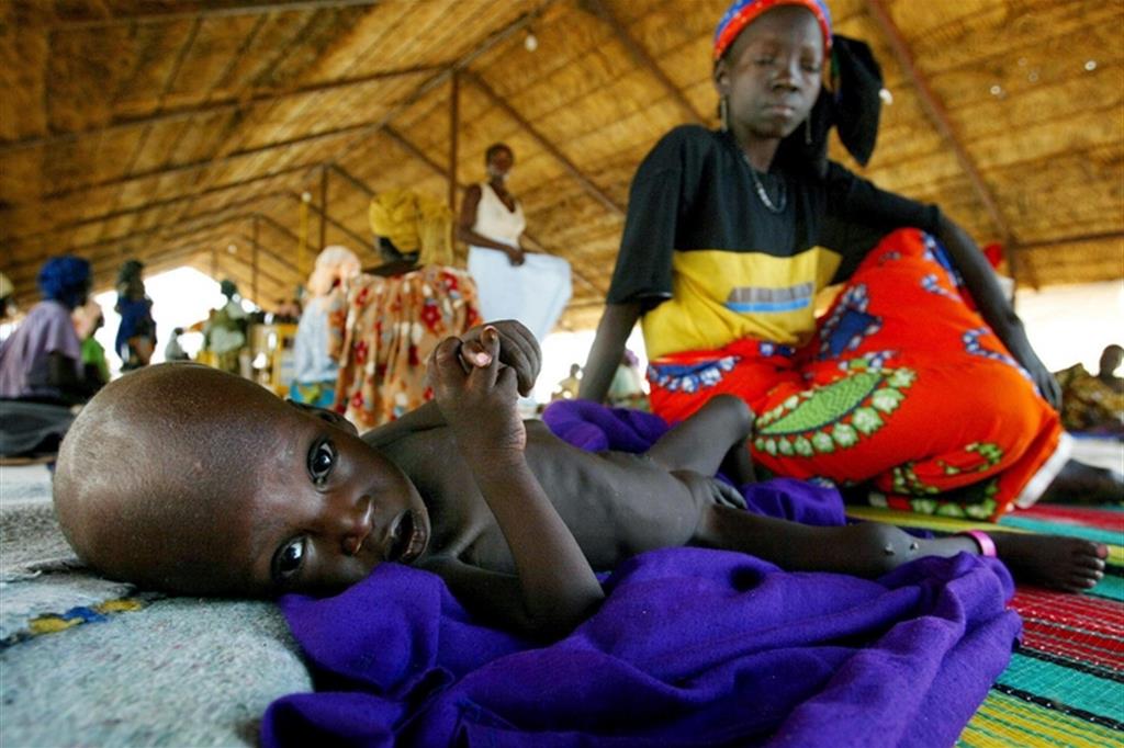 Denutrizione prima malattia dei bimbi in Niger