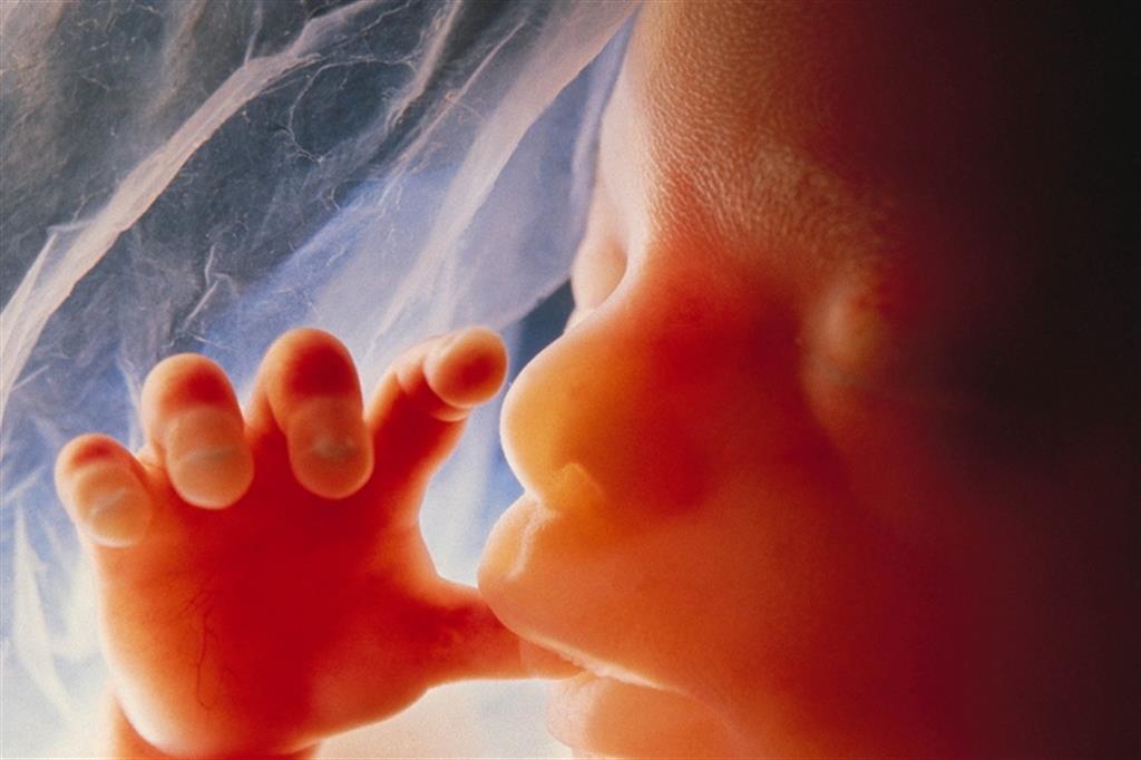 Irlanda, il feto ha molti diritti. Non solo alla vita