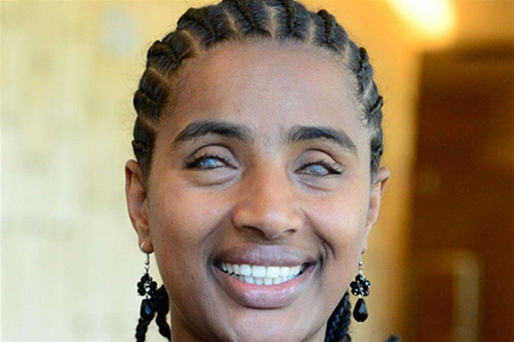 Yetnebersh Nigussie Molla, ha 35 anni e vive in Etiopia