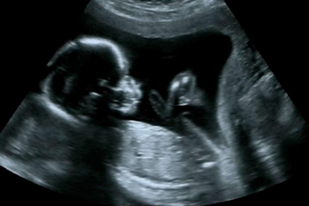 Il nascituro e la coscienza che nasce dall'«evidenza» di un'ecografia