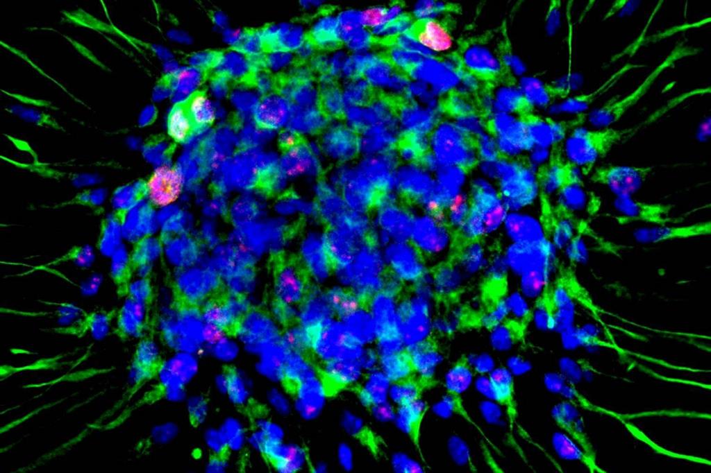 Aggregato di cellule staminali neurali in coltura