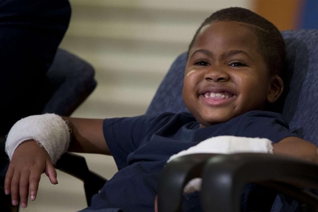 Zion Harvey, 8 anni di Baltimora, sorride dopo l'intervento chirurgico