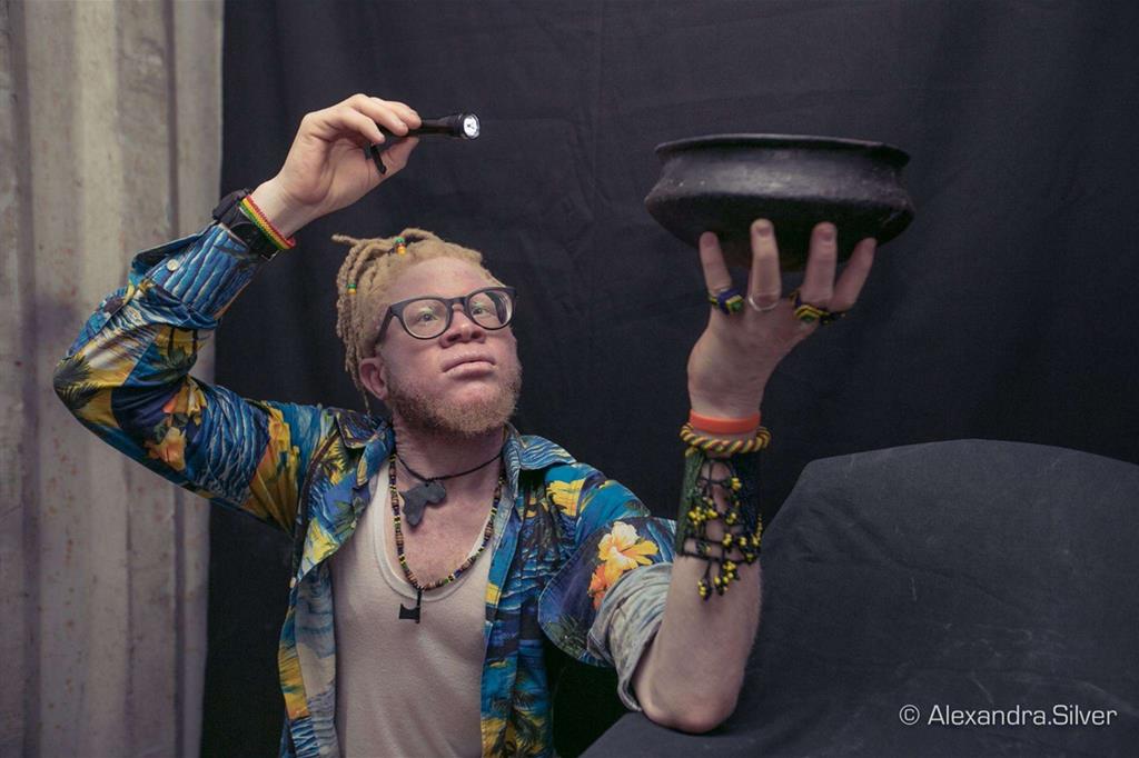 Il rapper della Tanzania Sixmund Mdeka canta per i diritti degli albini: nel suo Paese sono circa 100mila (Alessandra Argenti)