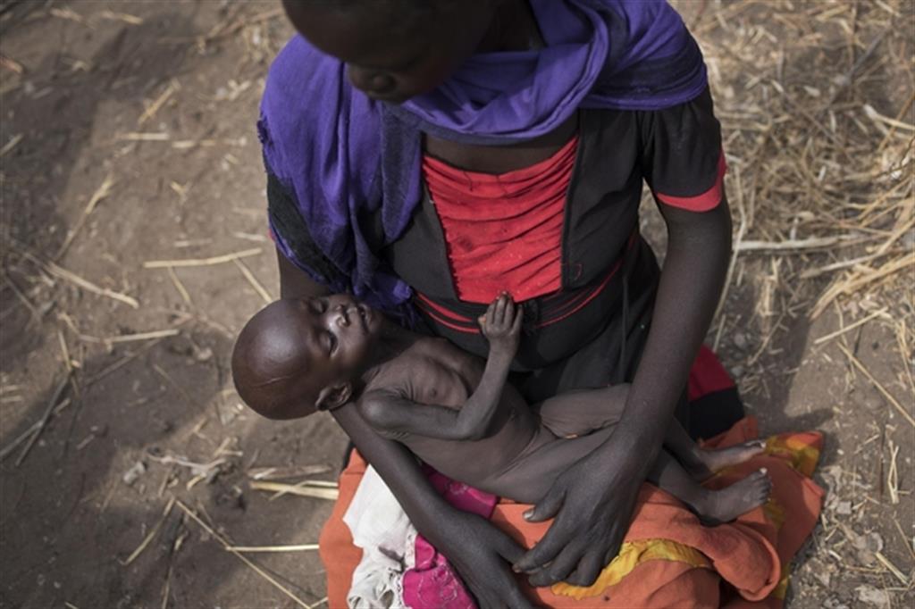Un bambino denutrito in Sud Sudan (Ansa/Ap)