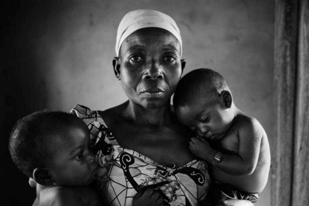 KASAI CENTRALE, REPUBBLICA DEMOCRATICA DEL CONGO – Foto di Léonard Pongo/NOOR Una mamma con i suoi due figli che hanno appena fatto un controllo presso il centro nutrizionale terapeutico locale a Lwemba. - 