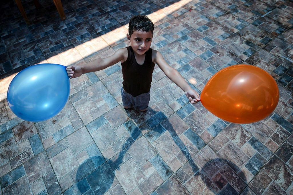 Questo è Mohammed Iariban, 5 anni. Ha perso le gambe in seguito ai bombardamenti israeliani su Gaza (Ansa) - 