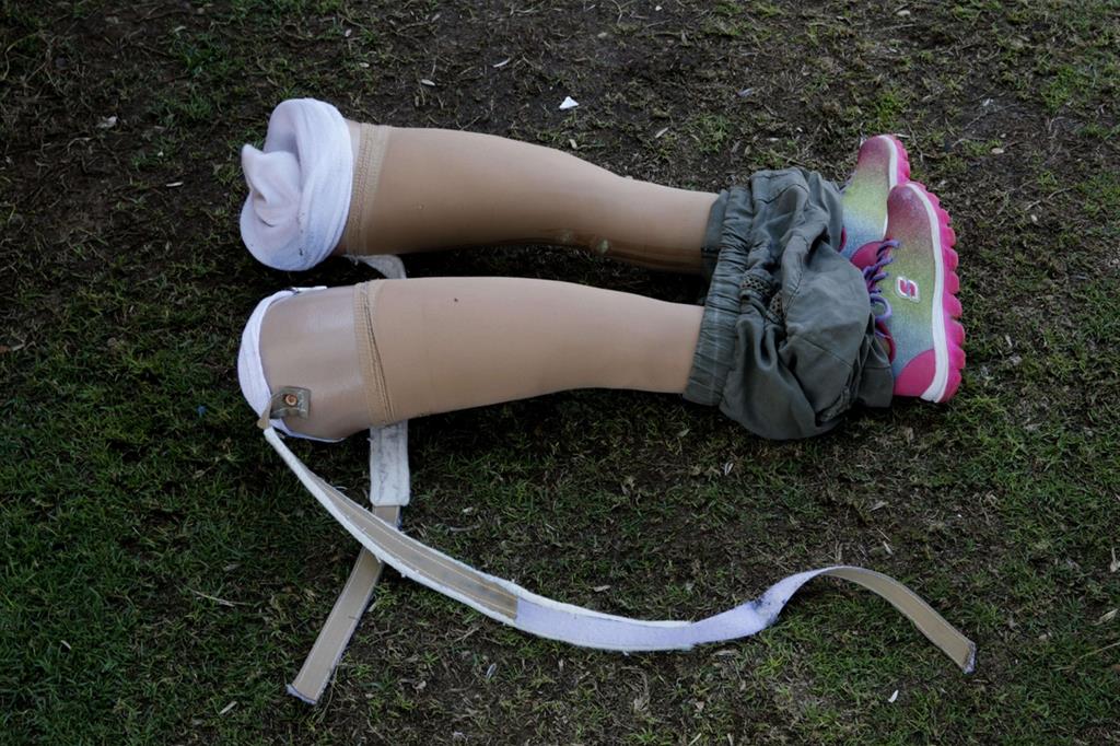 Per un tuffo in piscina si lasciano a terra le protesi: ecco quelle di una bambina (Ansa) - 