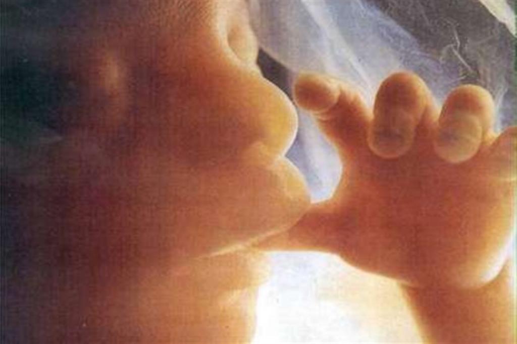 Cassazione: il feto durante il travaglio è una persona