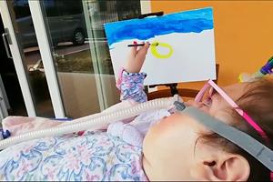 Noemi, 8 anni, malata di Sma1: «Vi racconto perché non mi arrendo»
