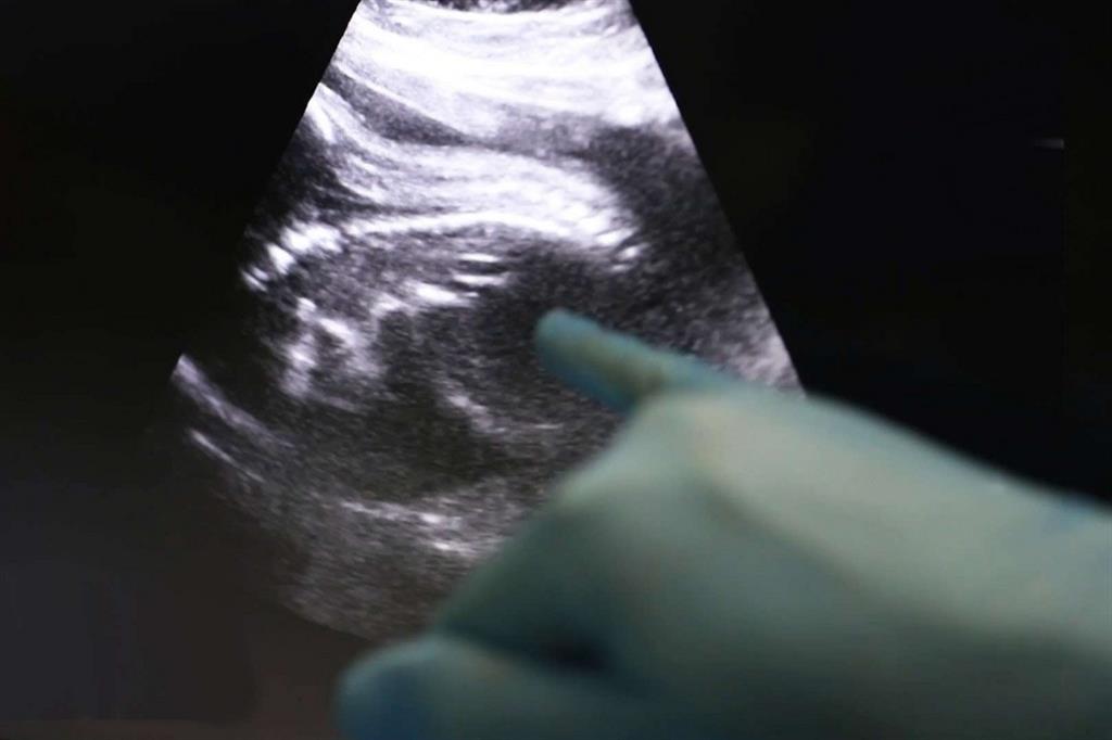 L'ecografia del feto durante l'operazione