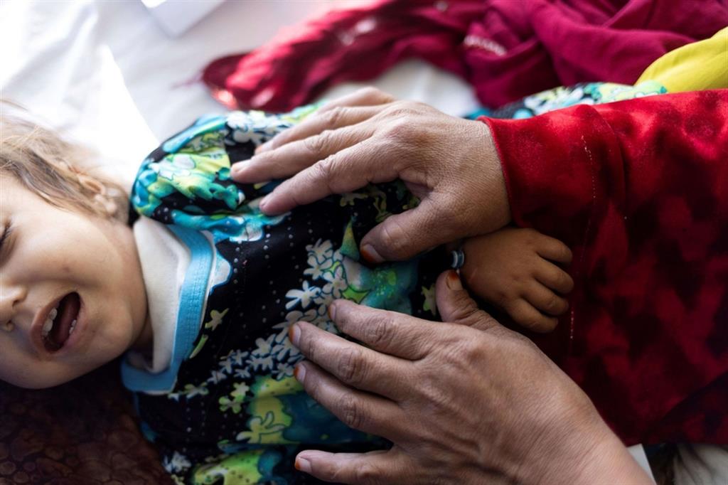 Una madre consola un bimbo ricoverato nel reparto di malnutrizione infantile all'ospedale Indra Gandhi di Kabul