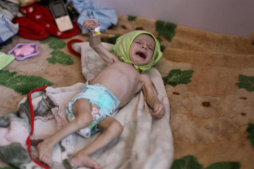 Un bambino piange all'ospedale al-Sabeen di Sanaa