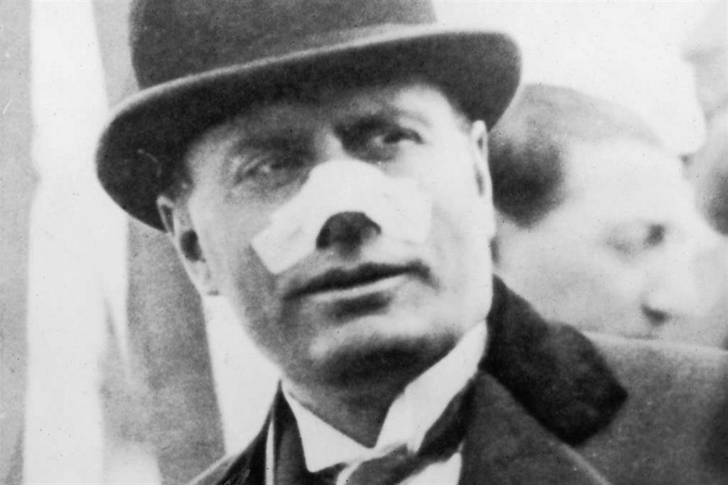 Mussolini con un vistoso cerotto sul naso nei giorni successivi all'attentato perpetrato da Violet Gibson nel 1926
