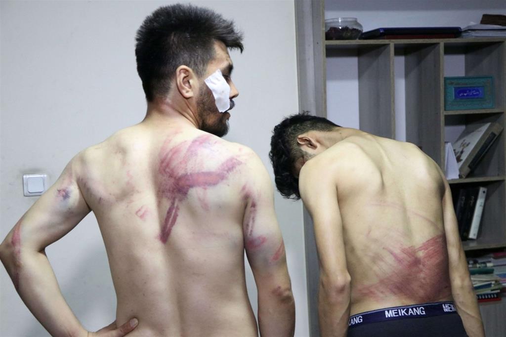 Due dei reporter rilasciati dai taleban con i segni sulla schiena delle torture
