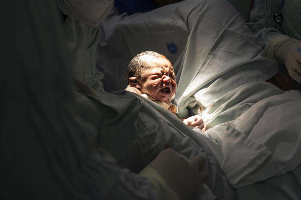 Un bambino appena nato in sala parto