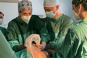 Fratellini operati in utero con successo alla 26esima settimana di gravidanza