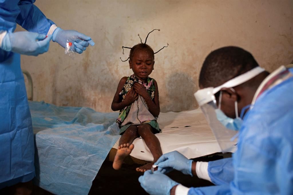 Anche l’elementare assistenza medica è impossibile in molte aree del Congo
