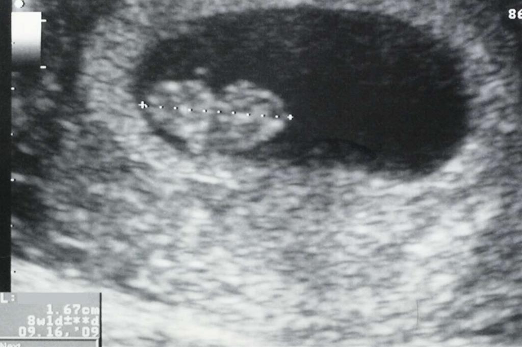Un feto umano a 8 settimane, lungo meno di due centimetri